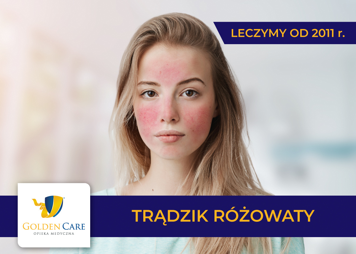 Trądzik różowaty