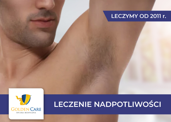 Leczenie nadpotliwości