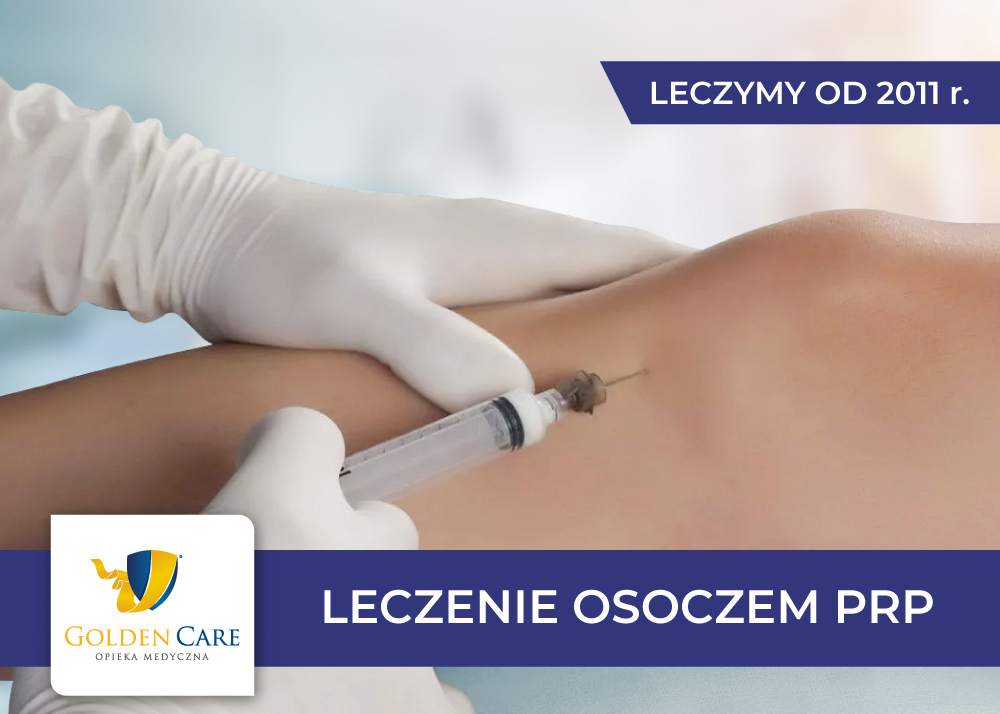 Leczenie osoczem PRP