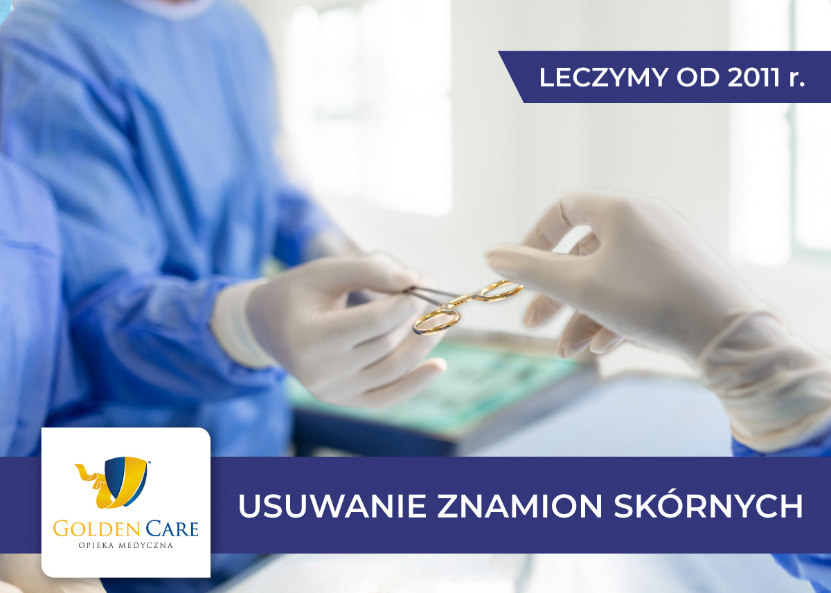 Usuwanie zmian skórnych